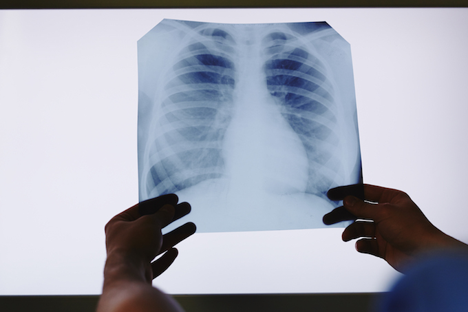 The-Expense-X-Ray-Process The Expense X-Ray Process
